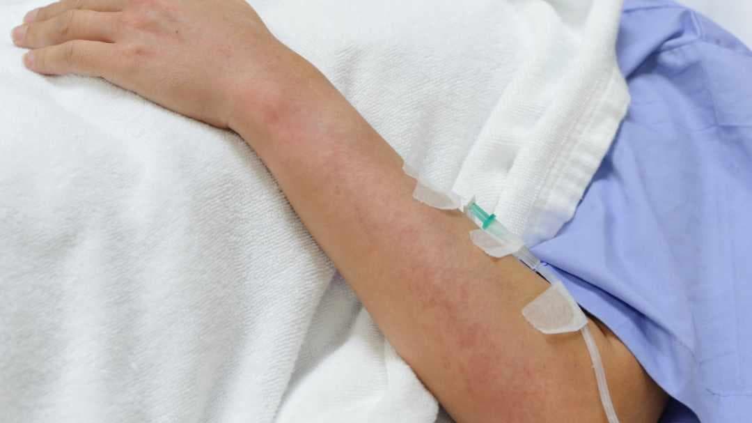 Epidemic Deaths Due to Leptospirosis: എലിപ്പനി മൂലമുണ്ടാകുന്ന മരണങ്ങൾ ആശങ്കയുയർത്തുന്നു