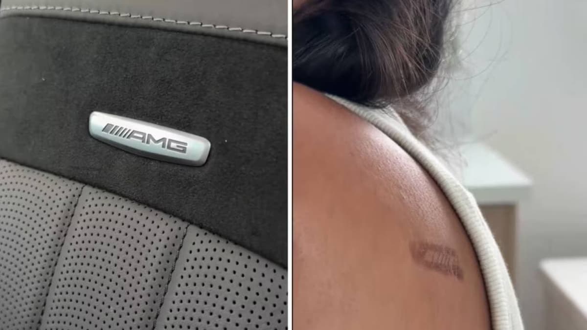 Mercedes Logo Burn Incident: ബെൻസ് ലോഗോ വെയിലത്തു ചൂടായി പൊള്ളലേറ്റതായി ആരോപണം; വീഡിയോയുമായി യുവതി
