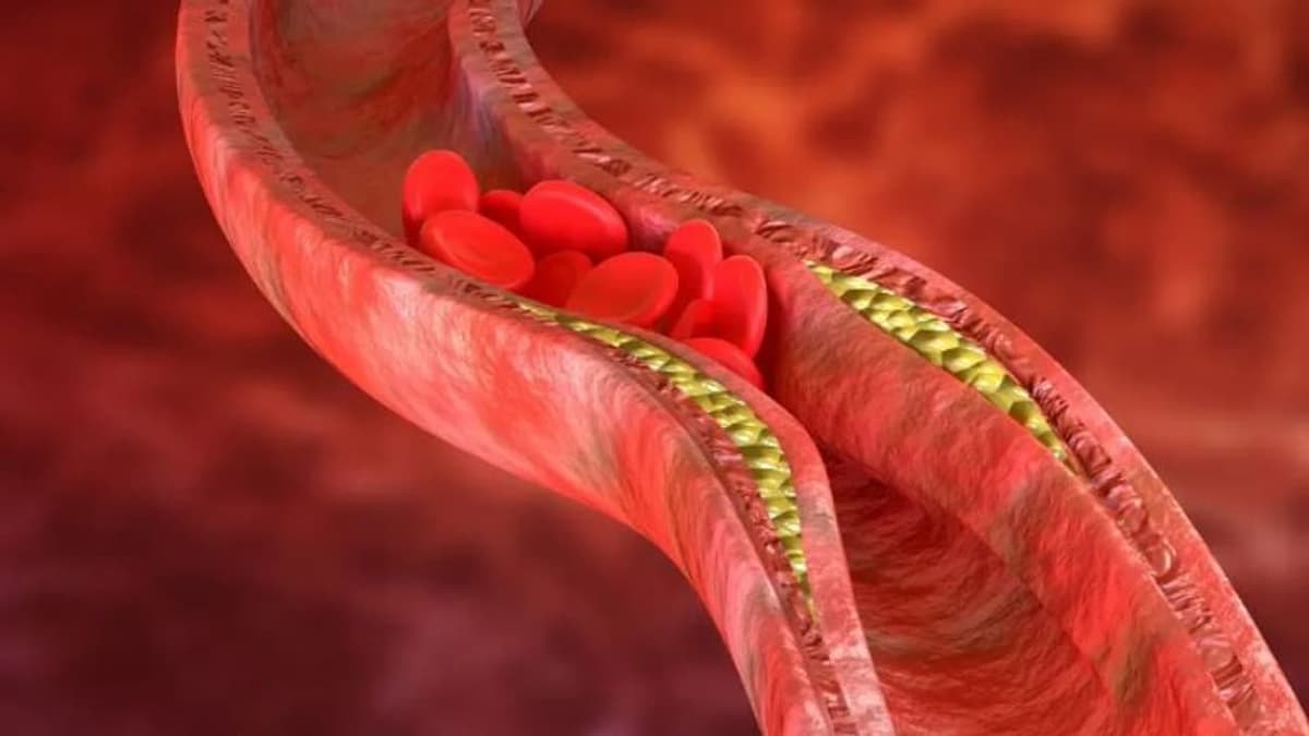 Stress and Diet:കൊളസ്ട്രോൾ വർദ്ധിക്കുന്നതിന് പിന്നിലെ രണ്ട് പ്രധാന കാരണങ്ങൾ